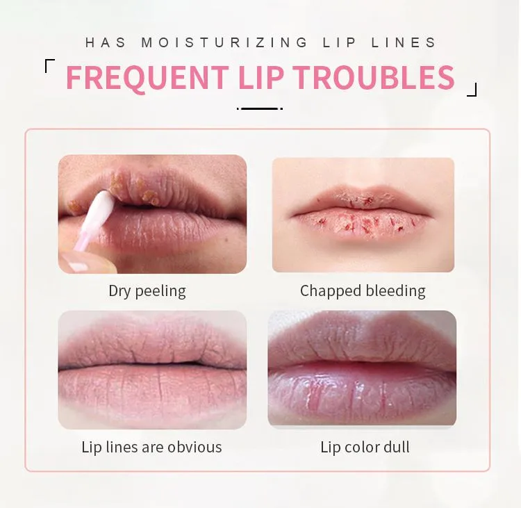 private-label-Lip-Sleeping-Mask