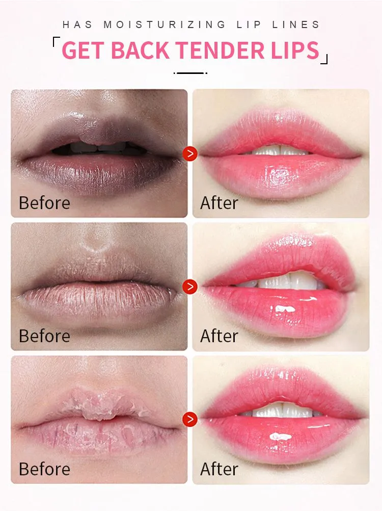 private-label-Lip-Sleeping-Mask